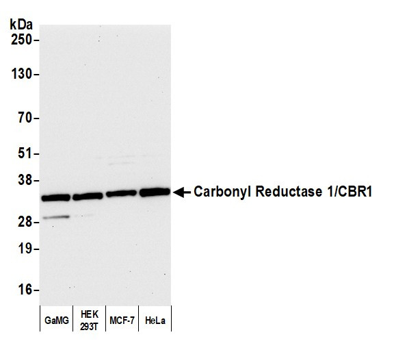 Carbonyl Reductase 1/CBR1 Antibody in Western Blot (WB)