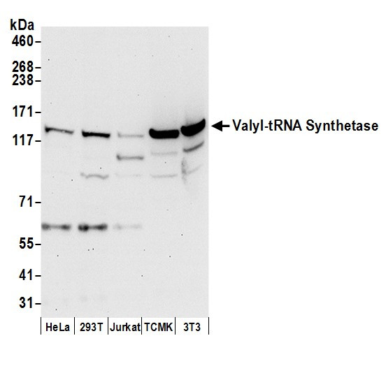 Valyl-tRNA Synthetase/VARS Antibody in Western Blot (WB)
