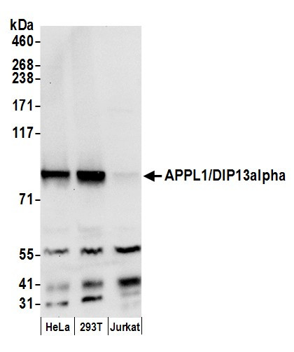APPL1/DIP13alpha Antibody in Western Blot (WB)