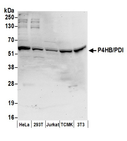 P4HB/PDI Antibody in Western Blot (WB)