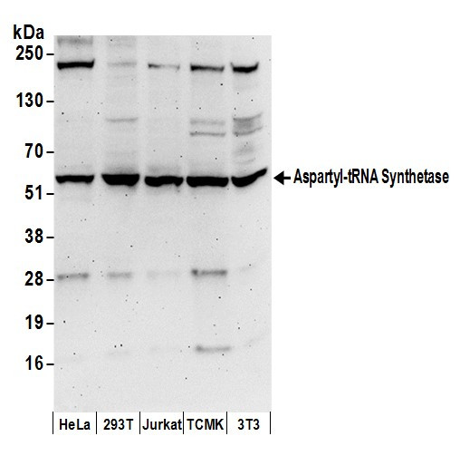 Aspartyl-tRNA Synthetase/DARS Antibody in Western Blot (WB)