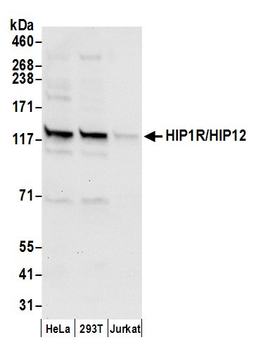 HIP1R/HIP12 Antibody in Western Blot (WB)