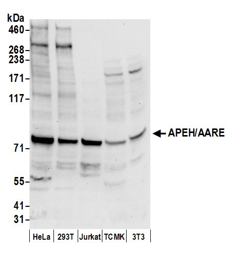 APEH/AARE Antibody in Western Blot (WB)