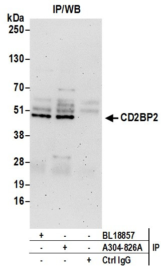 CD2BP2 Antibody in Immunoprecipitation (IP)
