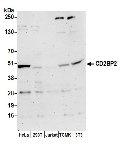 CD2BP2 Antibody in Western Blot (WB)