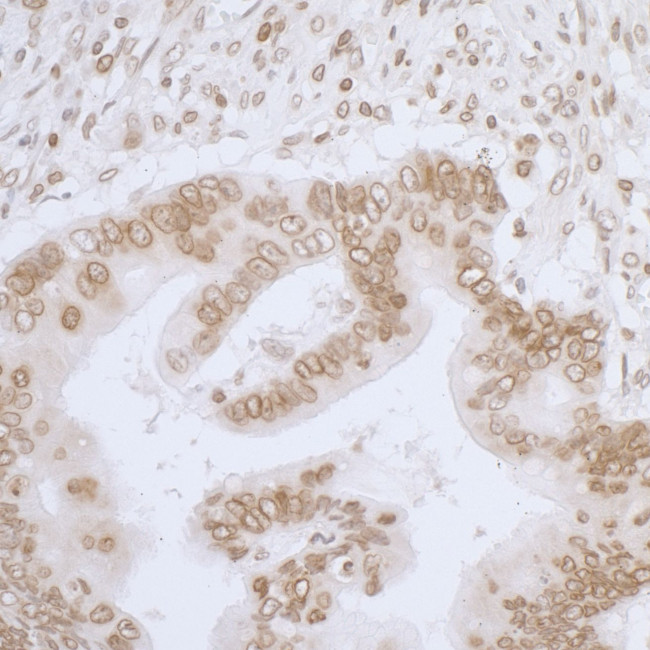 LAP2 alpha beta gamma/TMPO Antibody in Immunohistochemistry (Paraffin) (IHC (P))