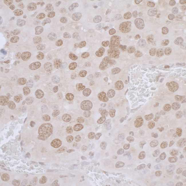 LAP2 alpha/TMPO Antibody in Immunohistochemistry (Paraffin) (IHC (P))