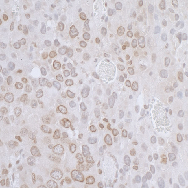 LAP2 beta/TMPO Antibody in Immunohistochemistry (Paraffin) (IHC (P))