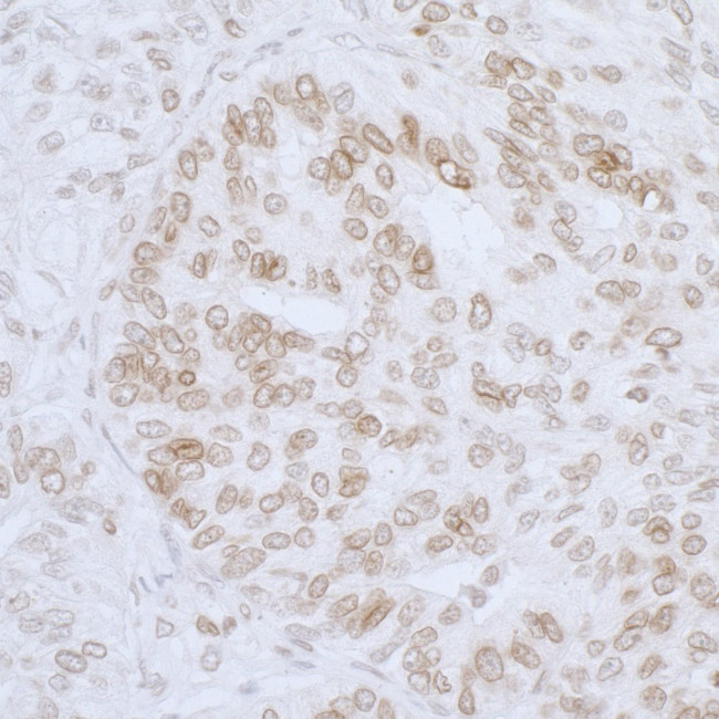 LAP2 beta/TMPO Antibody in Immunohistochemistry (Paraffin) (IHC (P))