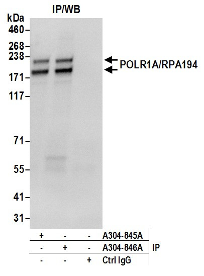 POLR1A/RPA194 Antibody in Immunoprecipitation (IP)