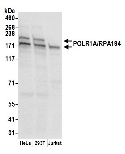 POLR1A/RPA194 Antibody in Western Blot (WB)