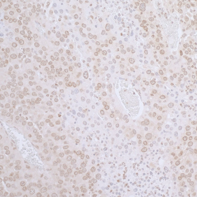 LAP2 beta gamma/TMPO Antibody in Immunohistochemistry (Paraffin) (IHC (P))