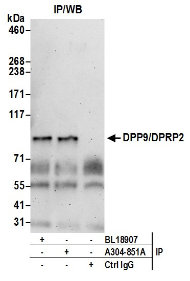DPP9/DPRP2 Antibody in Immunoprecipitation (IP)