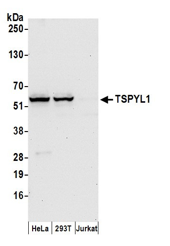 TSPYL1 Antibody in Western Blot (WB)