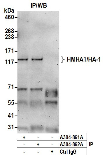 HMHA1/HA-1 Antibody in Immunoprecipitation (IP)
