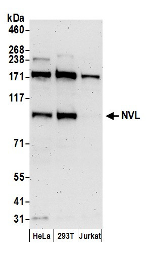 NVL Antibody in Western Blot (WB)