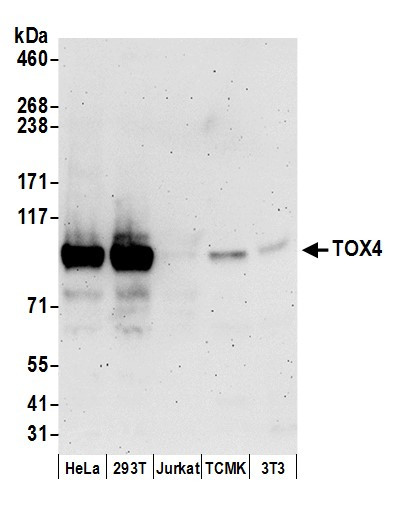 TOX4 Antibody in Western Blot (WB)