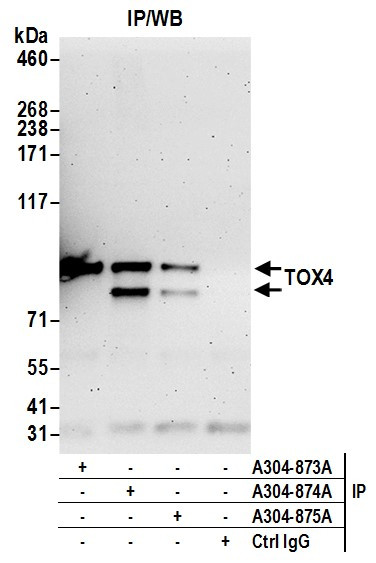 TOX4 Antibody in Immunoprecipitation (IP)