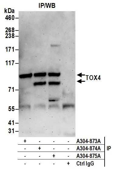 TOX4 Antibody in Immunoprecipitation (IP)