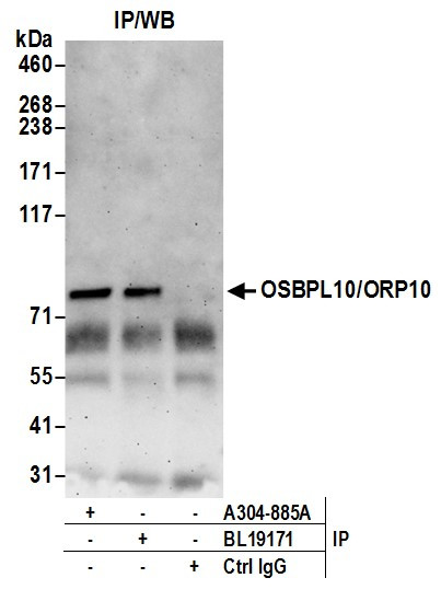 OSBPL10/ORP10 Antibody in Immunoprecipitation (IP)