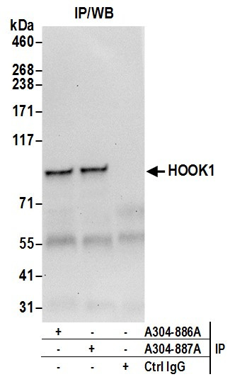 HOOK1 Antibody in Immunoprecipitation (IP)