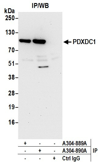 PDXDC1 Antibody in Immunoprecipitation (IP)