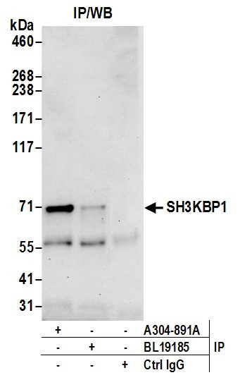 SH3KBP1 Binding Protein 1/SHKBP1 Antibody in Immunoprecipitation (IP)
