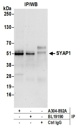 SYAP1 Antibody in Immunoprecipitation (IP)