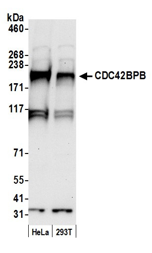 CDC42BPB/MRCK beta Antibody in Western Blot (WB)