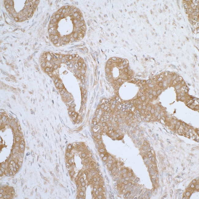 AIMP1/EMAPII/SCYE1 Antibody in Immunohistochemistry (Paraffin) (IHC (P))