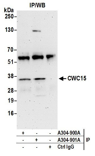 CWC15 Antibody in Immunoprecipitation (IP)