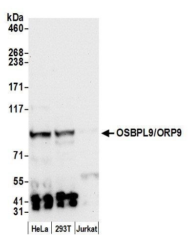 OSBPL9/ORP9 Antibody in Western Blot (WB)