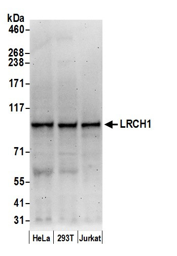 LRCH1 Antibody in Western Blot (WB)