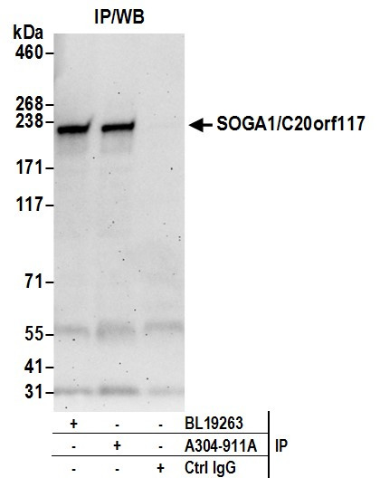 SOGA1/C20orf117 Antibody in Immunoprecipitation (IP)