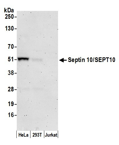 Septin 10/SEPT10 Antibody in Western Blot (WB)