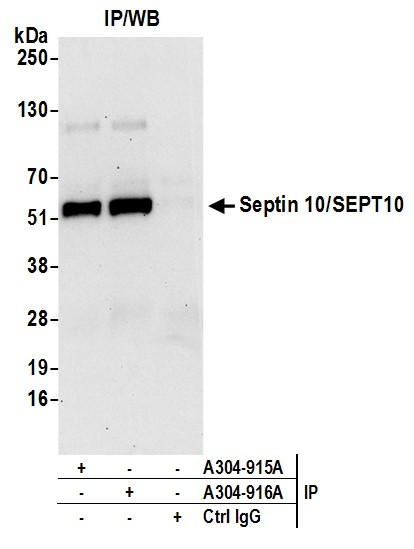 Septin 10/SEPT10 Antibody in Immunoprecipitation (IP)