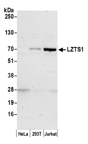 LZTS1 Antibody in Western Blot (WB)
