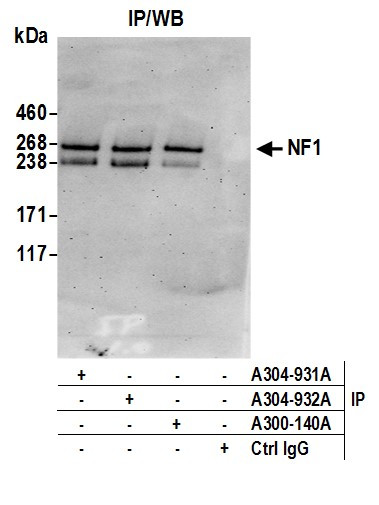 NF1 Antibody in Immunoprecipitation (IP)