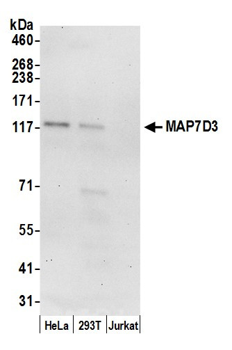 MAP7D3 Antibody in Western Blot (WB)