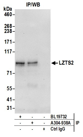 LZTS2 Antibody in Immunoprecipitation (IP)
