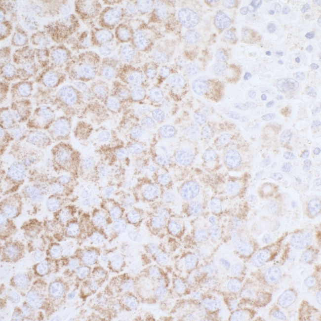 ATP5A1 Antibody in Immunohistochemistry (Paraffin) (IHC (P))