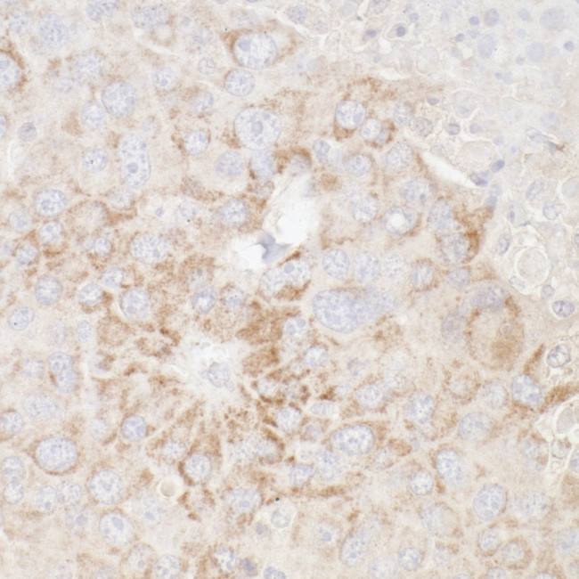 ATP5A1 Antibody in Immunohistochemistry (Paraffin) (IHC (P))