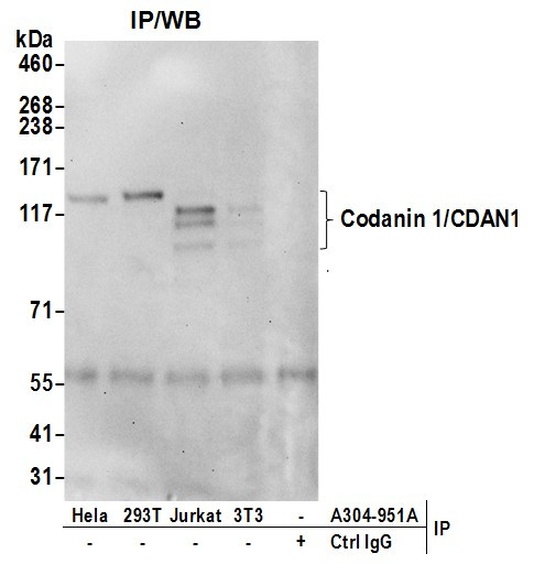 Codanin 1/CDAN1 Antibody in Immunoprecipitation (IP)