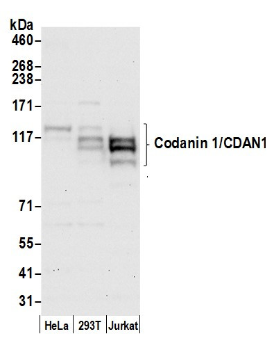 Codanin 1/CDAN1 Antibody in Western Blot (WB)
