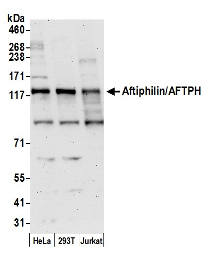Aftiphilin/AFTPH Antibody in Western Blot (WB)
