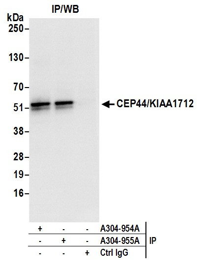 CEP44/KIAA1712 Antibody in Immunoprecipitation (IP)