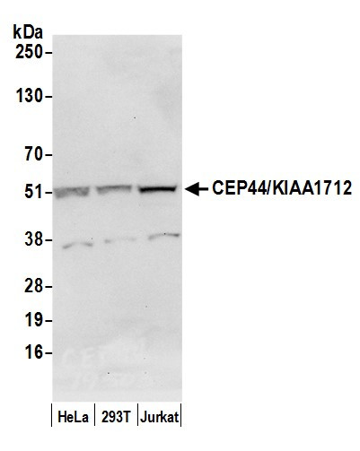 CEP44/KIAA1712 Antibody in Western Blot (WB)