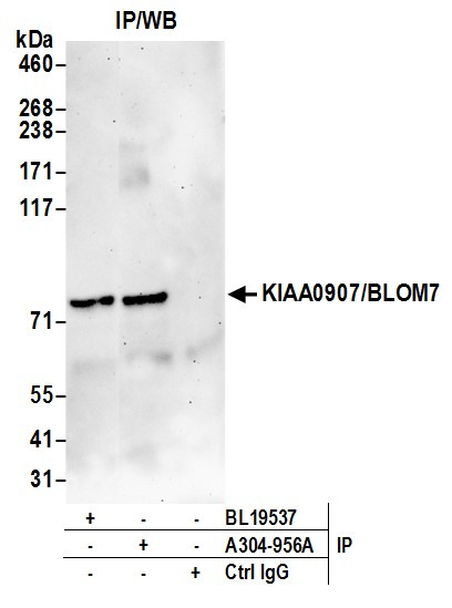 KIAA0907/BLOM7 Antibody in Immunoprecipitation (IP)