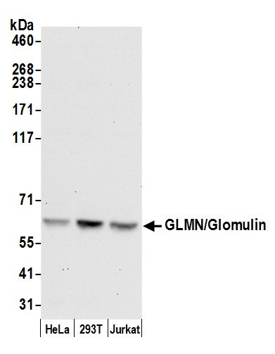 GLMN/Glomulin Antibody in Western Blot (WB)