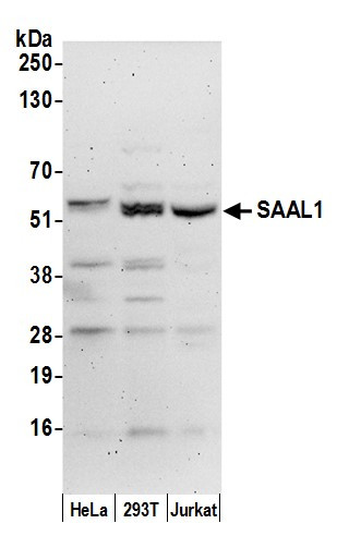 SAAL1 Antibody in Western Blot (WB)